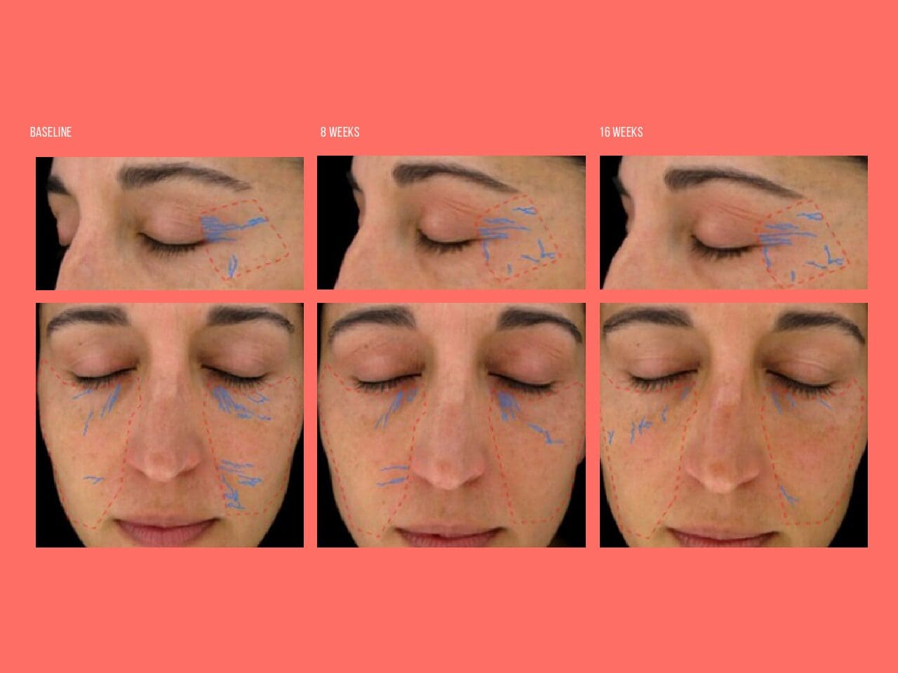 Optimsm 16 Week Study