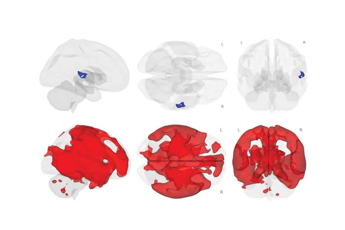 Graphic two brains showing MRI scan of how choline supports brain health after menopause